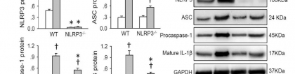 NLRP3促进AngⅡ诱导的血管平滑肌细胞表型转化，引发血管重构与高血压，血管平滑肌细胞