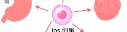 再生医疗中ips细胞和间叶系干细胞的含义及区别，ips细胞